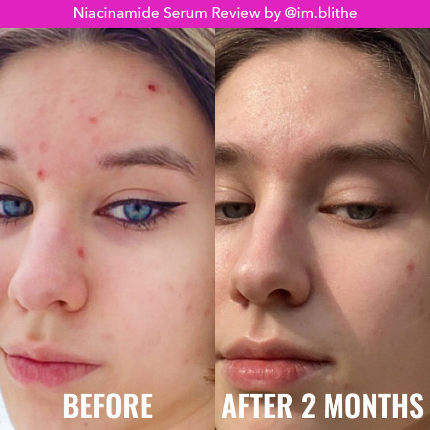 Good Molecules Niacinamide Serum 10%
