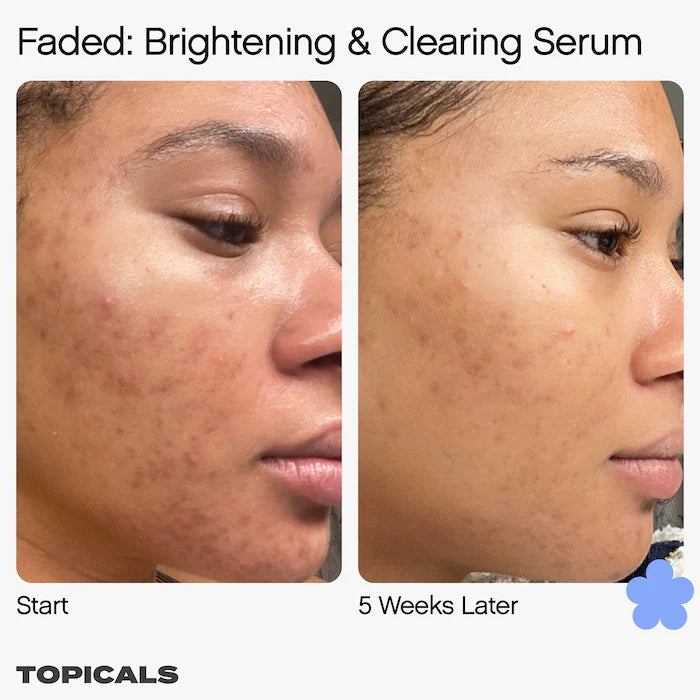 Topicals Faded Serum for Dark Spots & Discoloration